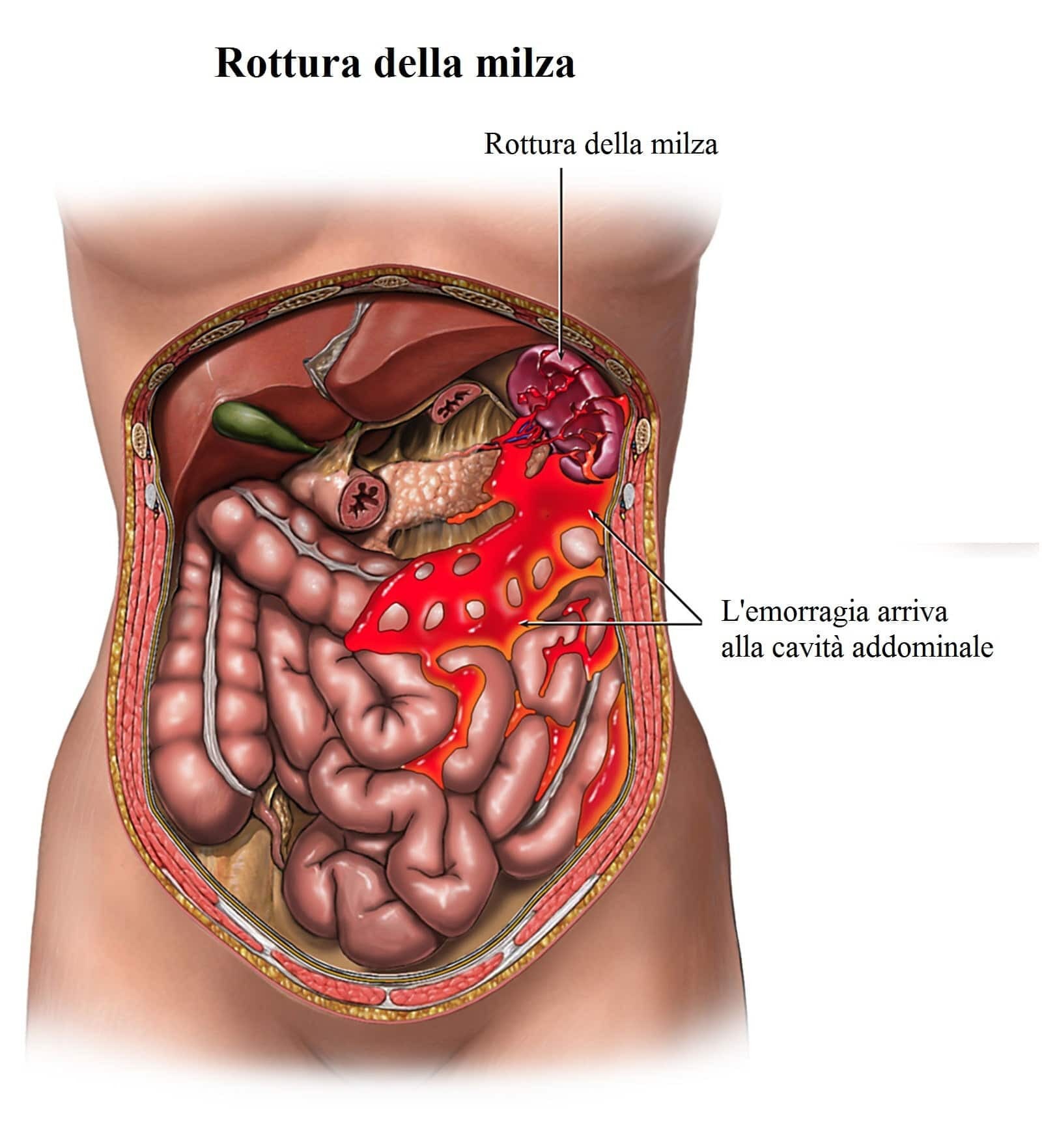 Dolore fianco sinistro 