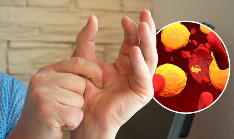 Colesterolo alto: sintomi alle mani