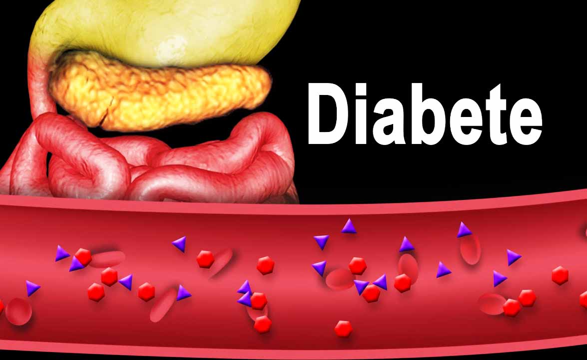 Il frutto di aprile perfetto per chi soffre di diabete. Lo abbassa del 19%!