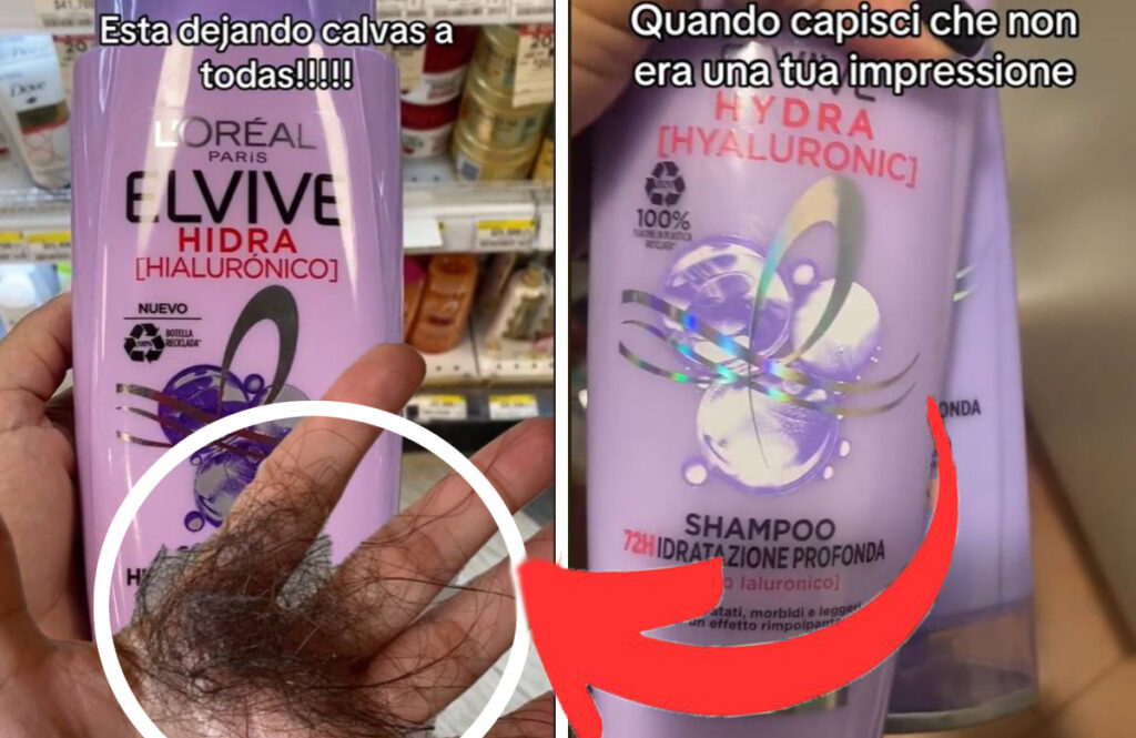 Questo Shampoo L’Oréal “mi ha fatto perdere i capelli”: tantissimi video su Tik tok che segnalano la notizia (ora si è aperta un’indagine)!